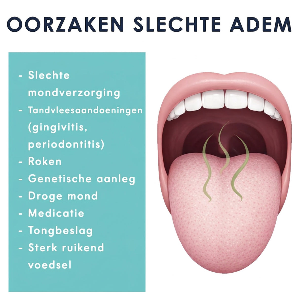 Cavex Fresh4sure infographic met oorzaken van slechte adem en open mond