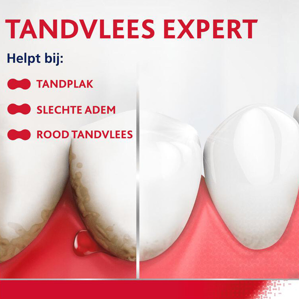 Parodontax tandvlees expert: tanden voor en na tegen tandplak en rood tandvlees