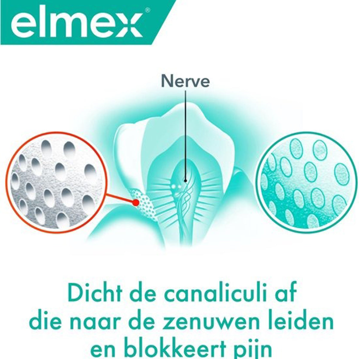 Elmex Sensitive Professional uitleg dichten canaliculi die pijn blokkeert bij zenuwen