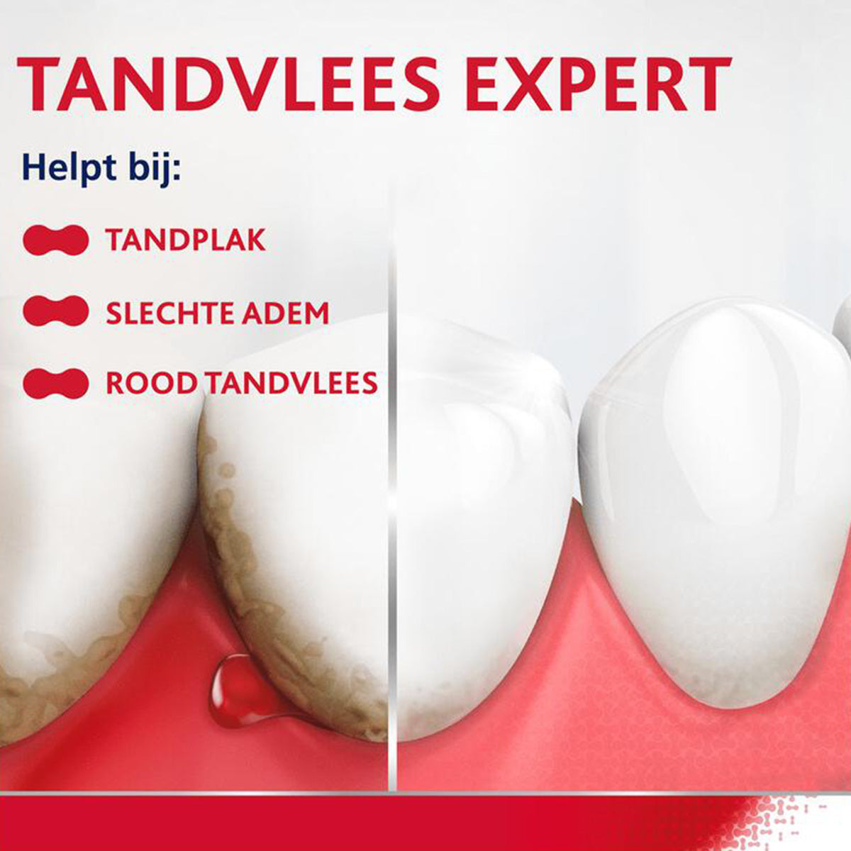 Parodontax Extra Fresh tandpasta helpt bij tandplak, slechte adem en rood tandvlees
