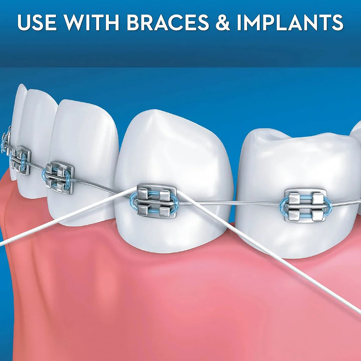 Oral-B Super Floss tussen tanden met beugel, tekst use with braces & implants