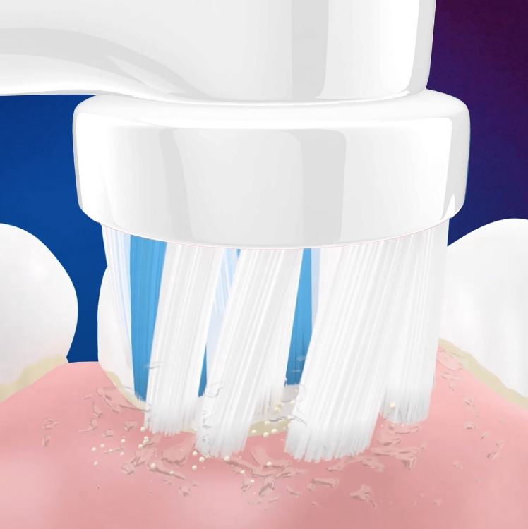 Oral-B Stages Power Kids Frozen close-up borstelkop op tanden en tandvlees