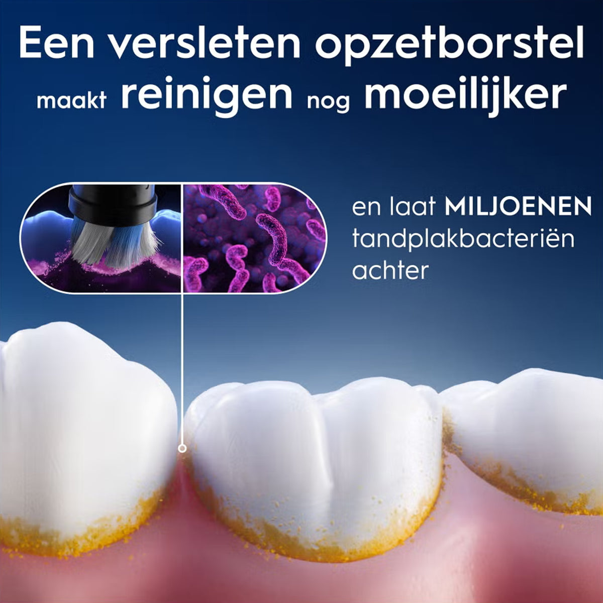Oral-B iO Gentle Care versleten opzetborstel laat miljoenen tandplakbacteriën achter
