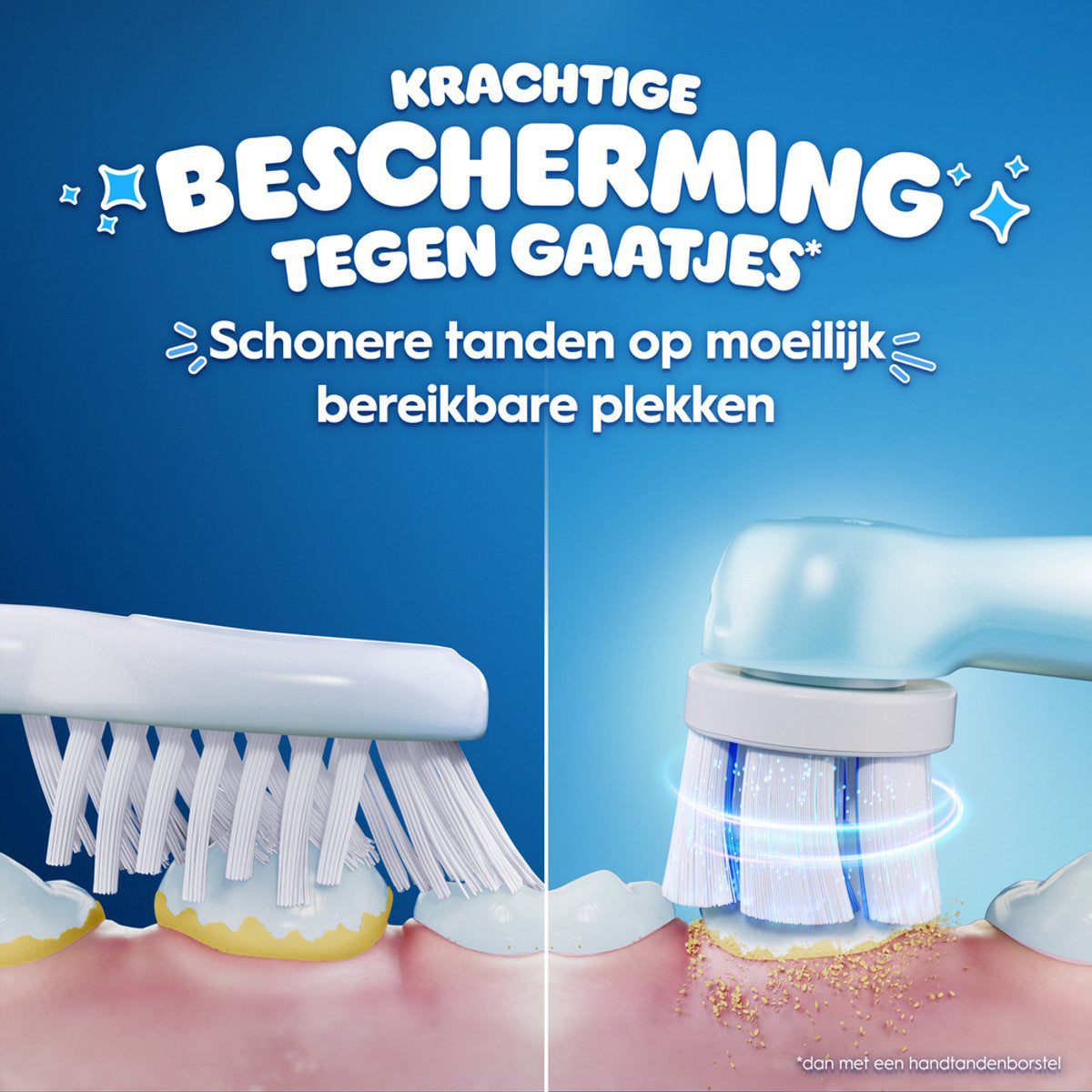 Oral-B vergelijking handtandenborstel en elektrische opzetborstel op tandplak