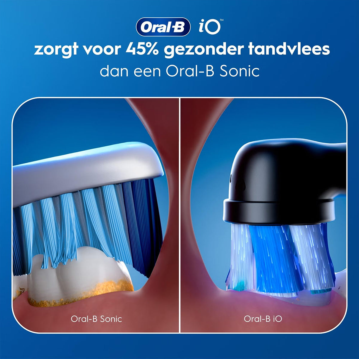 Oral-B iO vergelijking tandvlees: 45% gezonder dan Oral-B Sonic, close-up borstelkoppen