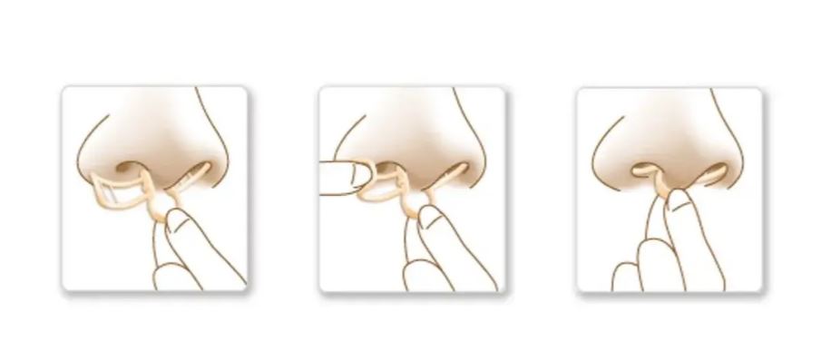 SleepRight Neusspreider 2-pack illustratie van plaatsing in de neus stap voor stap