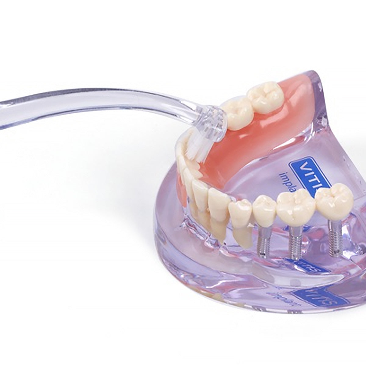 Vitis Implant Angular tandenborstel gebruikt op tandmodel met implantaten en kroon