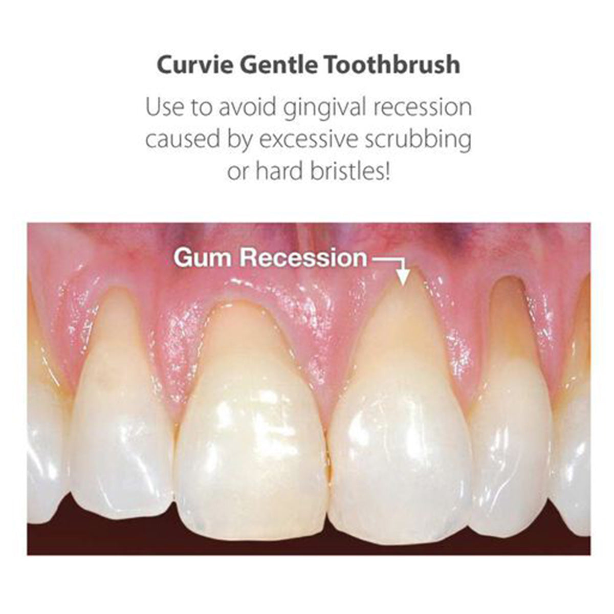 Piksters Curvie Gentle tandenborstel afbeelding met close-up van tandvleesrecessie bij tanden
