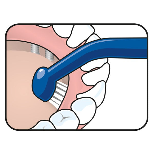 Tepe Universal Care tandenborstel illustratie van reiniging tandvlees en achterste tanden