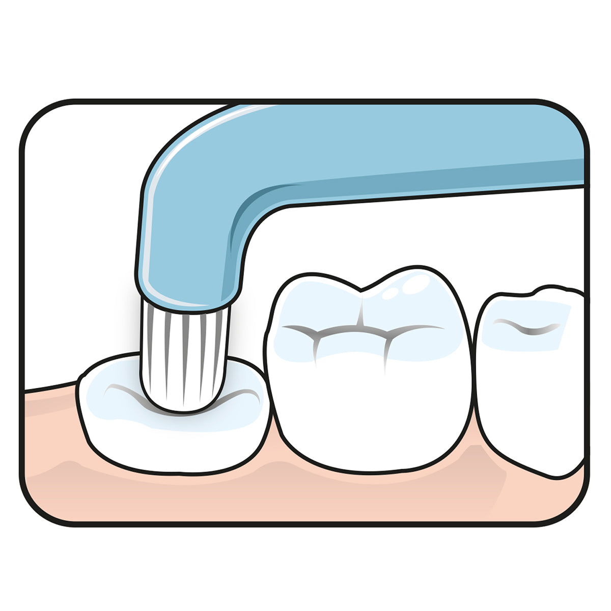 Tepe Compact Tuft tandenborstel poetst illustratie van kies langs tandvlees