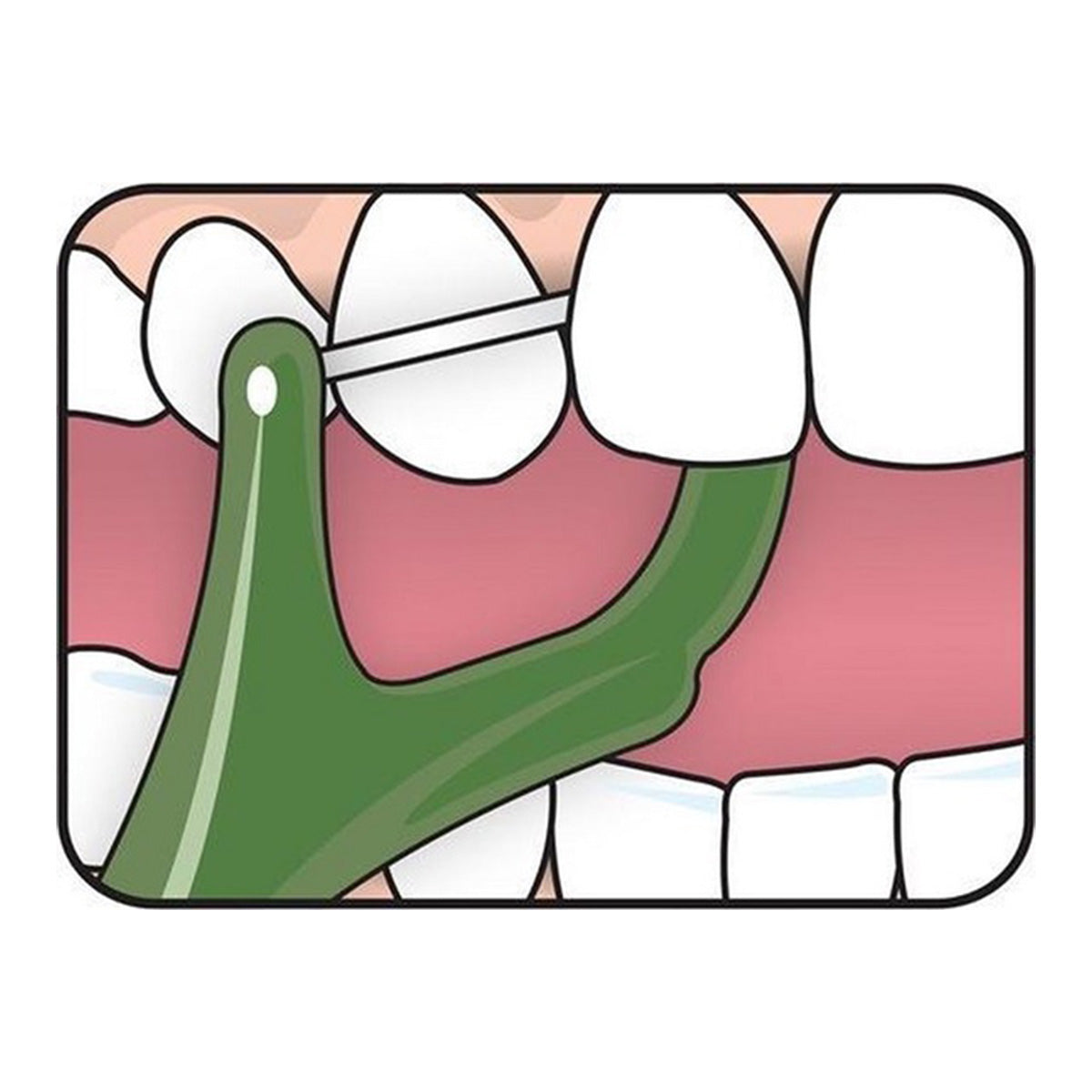 Tepe Mini Flosser illustratie van flossen tussen tanden in de mond