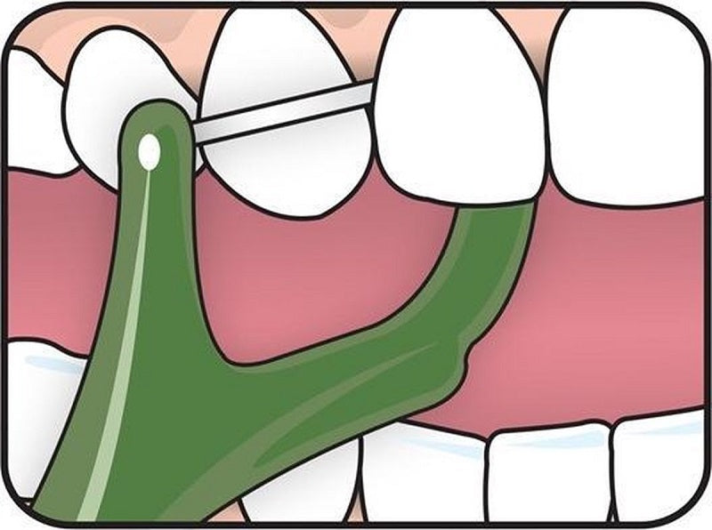 Tepe Mini Flosser illustratie van tandenstoker met floss tussen tanden gebruikt