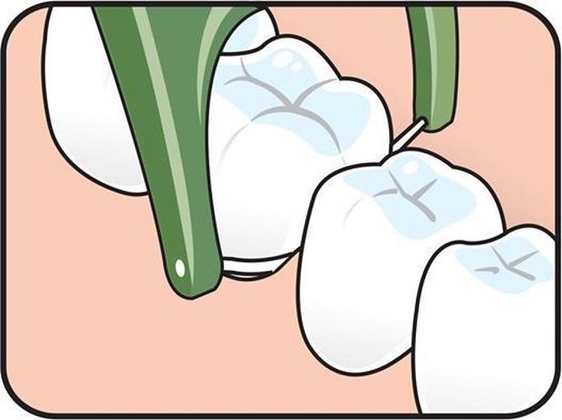 Tepe Mini Flosser illustratie van flosdraad tussen kiezen in de mond