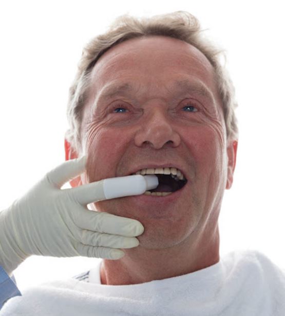 ViniGiGi pro vingerhoesje wordt bij patiënt in mond gebracht door behandelaar