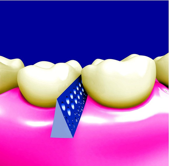 pikstix plastic tandenstokers met micro holes 3