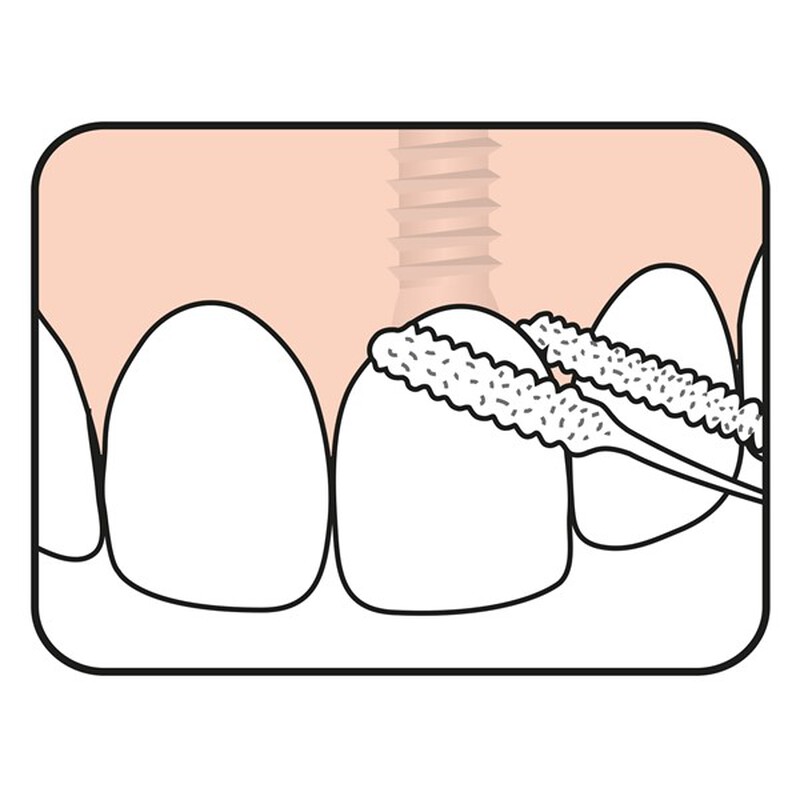tepe bridge & implant floss 3